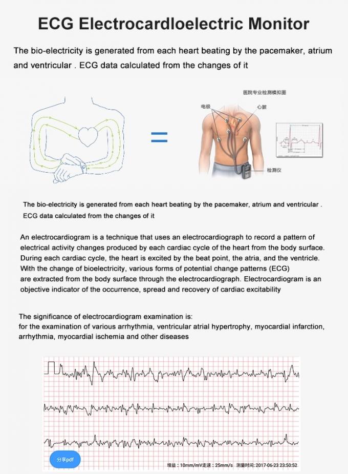 ECG 똑똑한 시계 단계 추적자 호흡 훈련 소맷동 24 시간 혈압 감시자