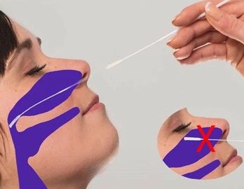 무리를 짓 3ml NP는 닦습니다